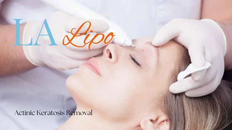 Woman receiving Actinic Keratosis Removal Treatment Balsall