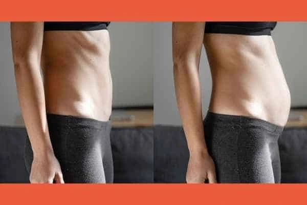 LA-EMS Body Sculpting results Balsall