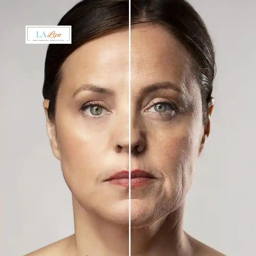 How Can You Tell If Non-Surgical Skin Tightening Is Right for You Balsall?