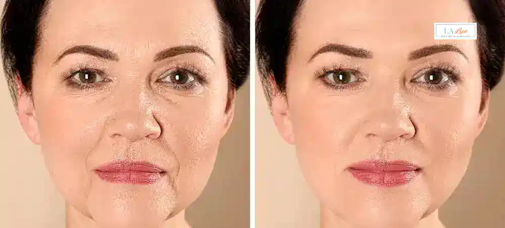 Why Aren’t My Skincare Products Making My Sagging Skin Look Firmer Balsall?