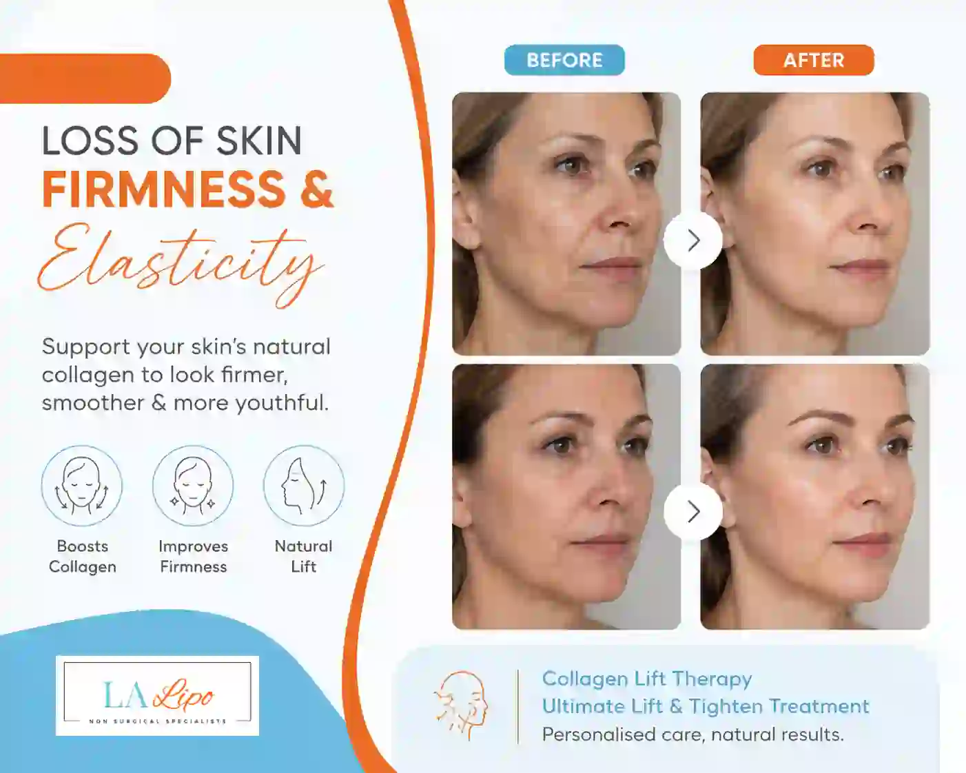 Sign #7: Loss of Skin Firmness and Elasticity Balsall