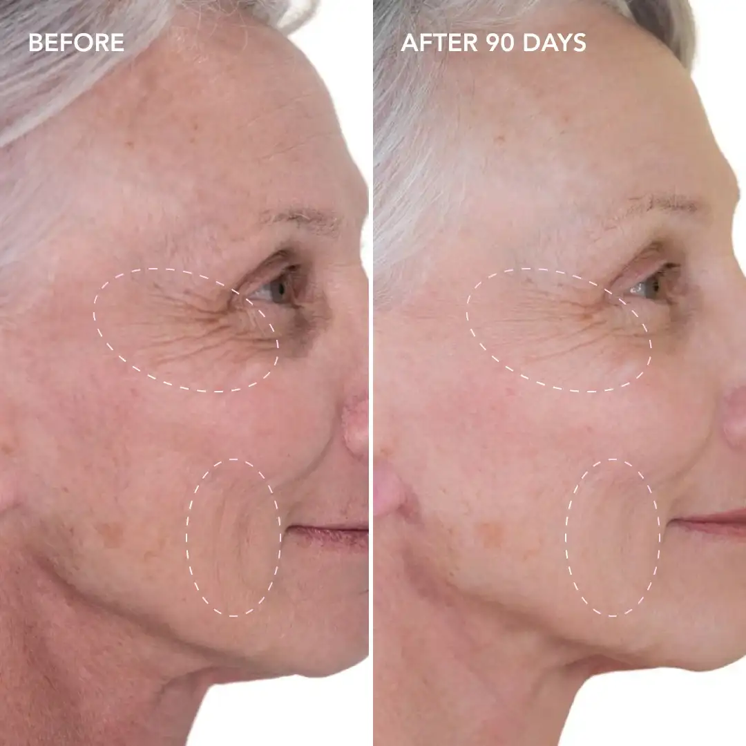 When will you see results Balsall